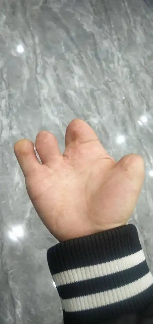 有没有适合残疾人的工作啊,今年23岁,从学校出来找