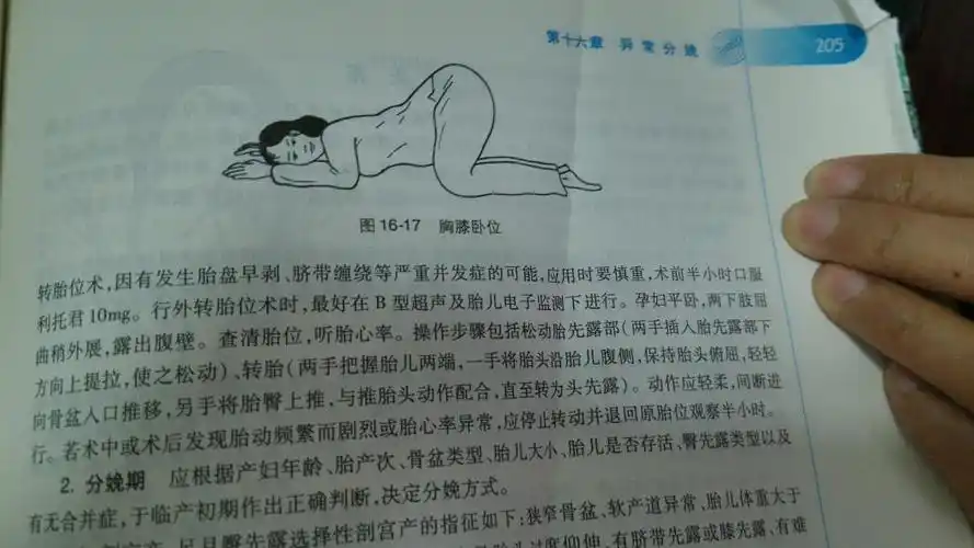 横位怎么变头位?