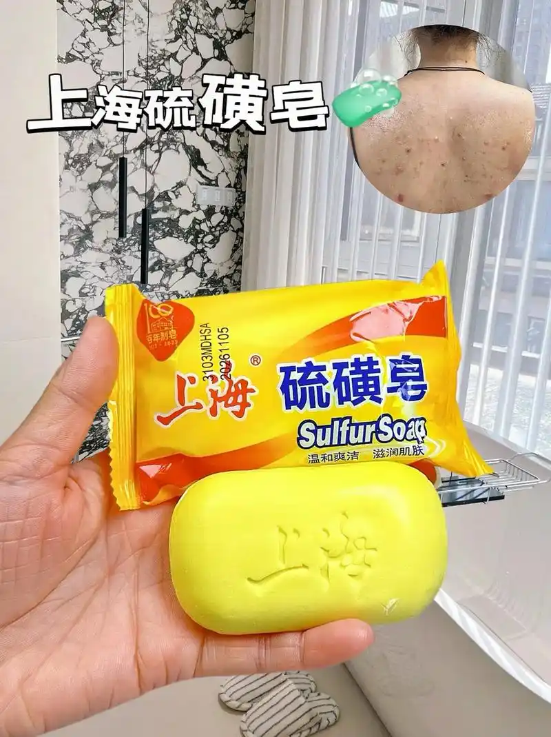 硫磺皂控制油脂分泌,灭杀细04和螨虫适用洗澡,洗头