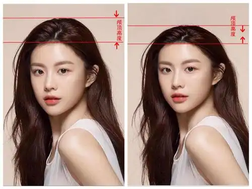 高颅顶绝对是近年来的审美标杆,无论是天生就拥有优越的高颅顶,还是