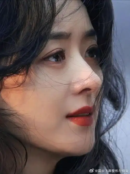 赵丽颖##武汉隆鼻##今日美貌营业