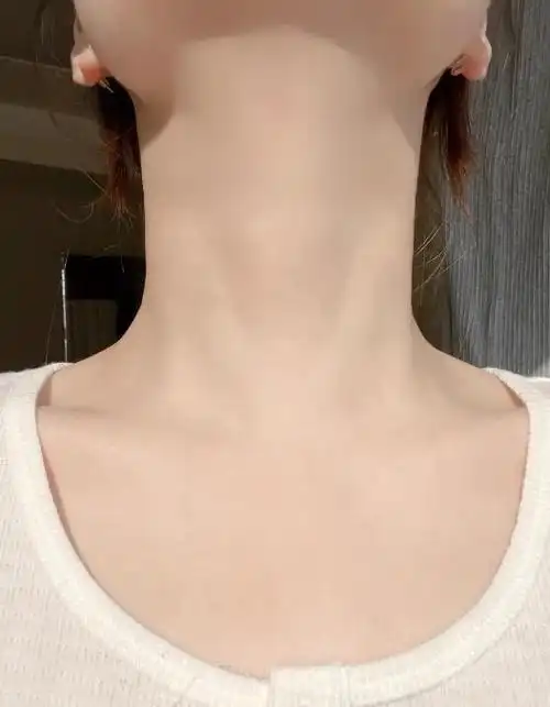 女生脖子出现"3道杠",真的不明白意味什么吗?别再傻傻不在意