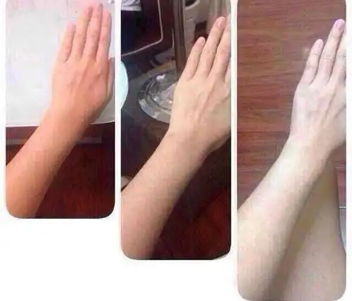 注射美白针对比图