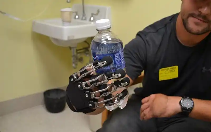 国外研发一款机械手指, 专为残障人士设计, 用起来跟原装一样灵活