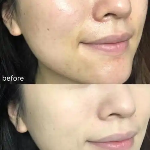 惠州黄女士使用前后对比惠州吴女士使用产品前后对比惠州张女士使用