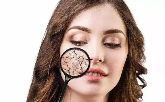 皮肤缺水图片,皮肤为什么会干燥缺水?-图片大观-奇异网