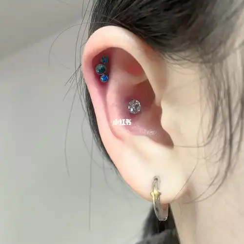 耳甲腔77耳轮骨穿刺