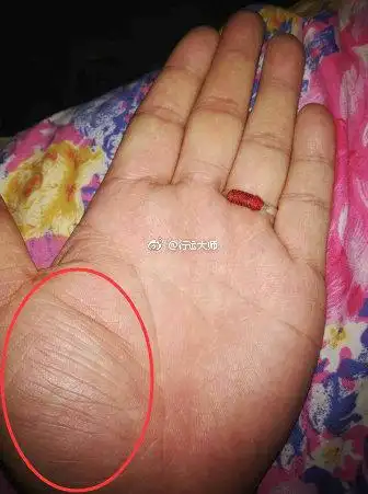 在手掌中大拇指下面鼓起来的一块,叫做金星丘可以发现双手的金星丘都