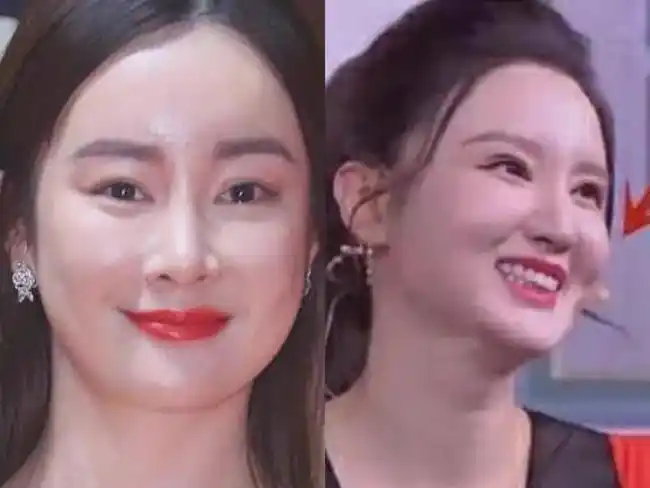 苹果肌判断女明星少女感为什么在素人身上没用