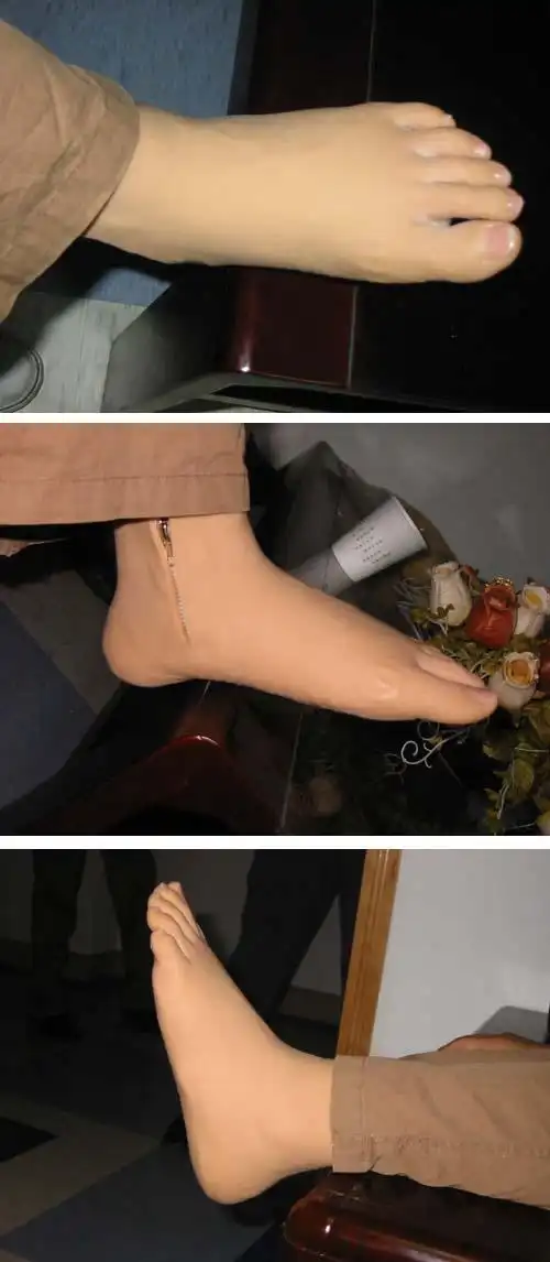 硅胶半足穿戴_穿戴效果_英中耐假肢矫形器(石家庄)有限公司