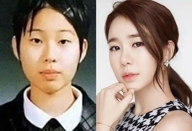 女神整容前能有多丑?朴敏英9年动了5次,刘仁娜整容痕迹明显