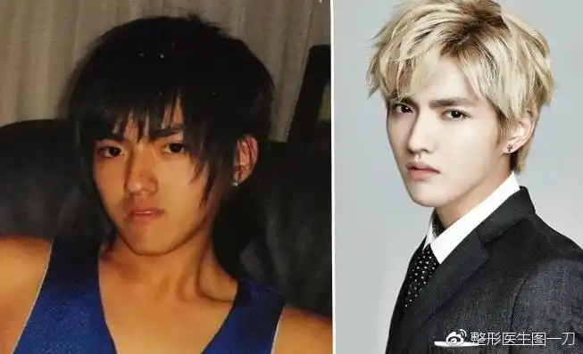 整容前后对比其实看吴亦凡从小到大的照片都是帅哥一枚,本来底子就好