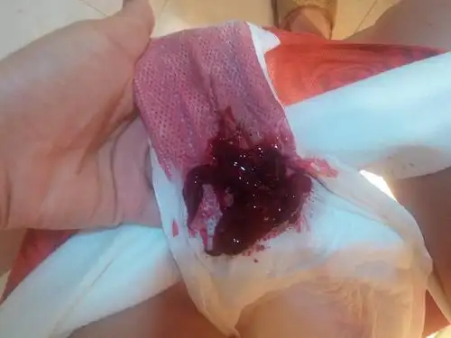 你好,我每个月9号来月经的但是这个月一直到昨天早上没来,在昨天早上