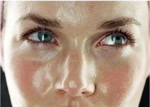 粗糙皮肤皮肤为什么会粗糙