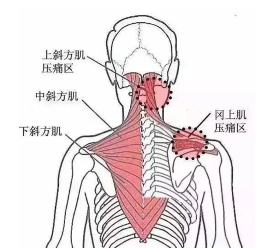 3个动作消除斜方肌