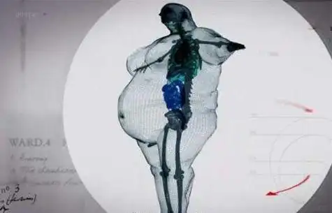 以后别再说自己胖是因为骨架大了