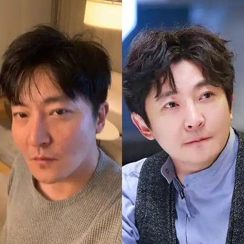 看看郭京飞割眼袋前后的对比图,效果非常明显.