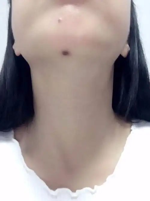 女生什么样的下巴好看图片(女生什么样的下巴好看图片真实)