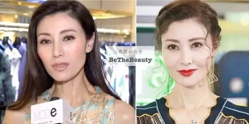 窄额头(所以要填充变高宽),大块颧骨(所以要内推),方腮靠下(因此要削