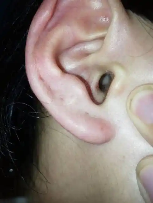 请问耳朵内堵的这是怎么个情况?