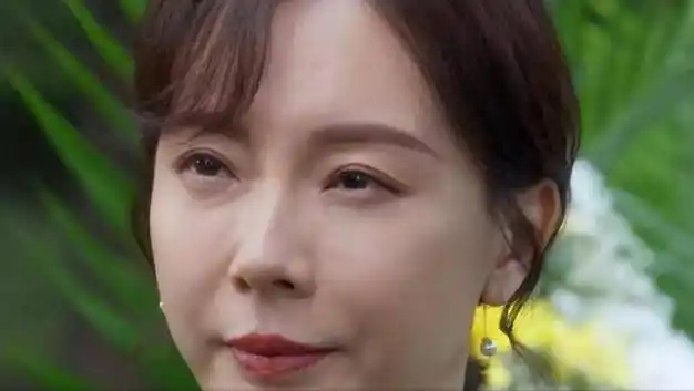 沉迷整容的陈数,后遗症凸显,终于明白自己被医美坑惨了!