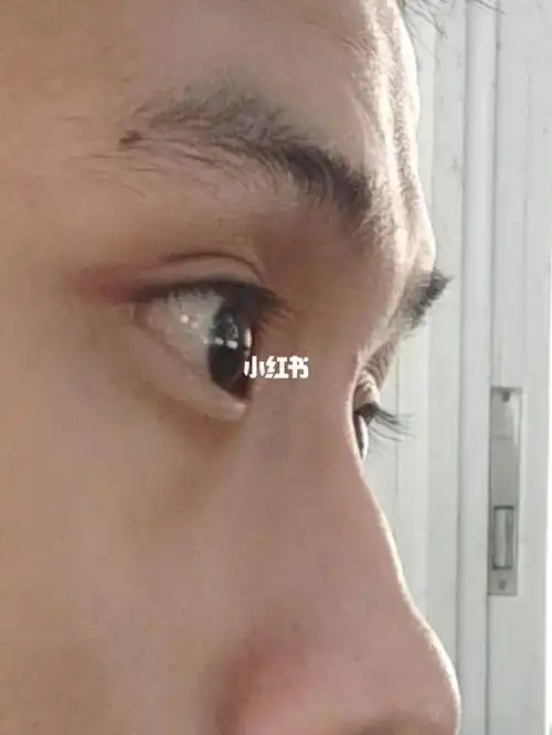 驼峰鼻到底是好看还是不好