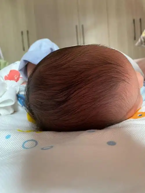 想问下这是什么头,宝宝出生才11天,我看不出来这是啥头型,我想要圆圆