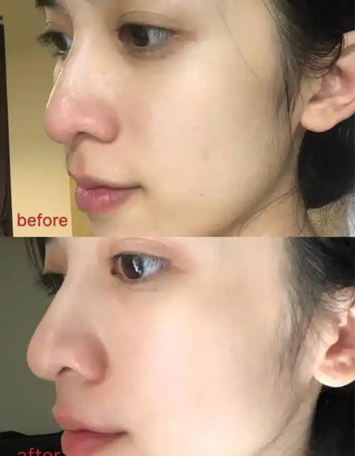 3位女星出道前后对比,最后一位差距最大,仿佛换了一个人_美容_皮肤