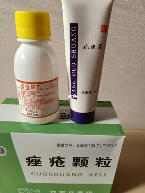 痤疮颗粒中药成份不依赖无副作用