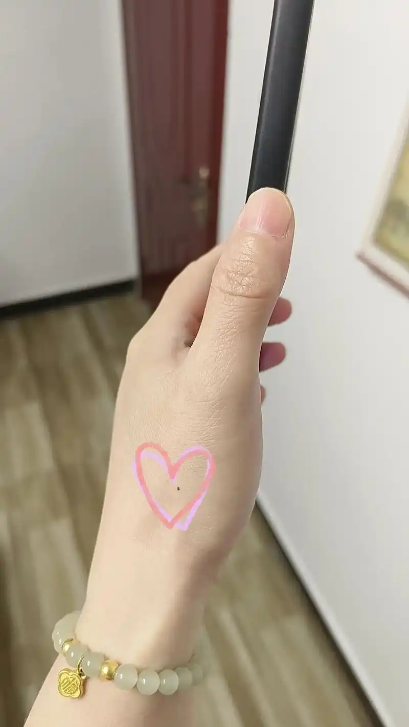 曾听人说,左手痣,时来运转,左手突然长痣说明你生命中出现了很重要的