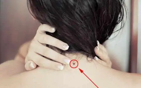 脖子后面有痣的人运势怎么样?