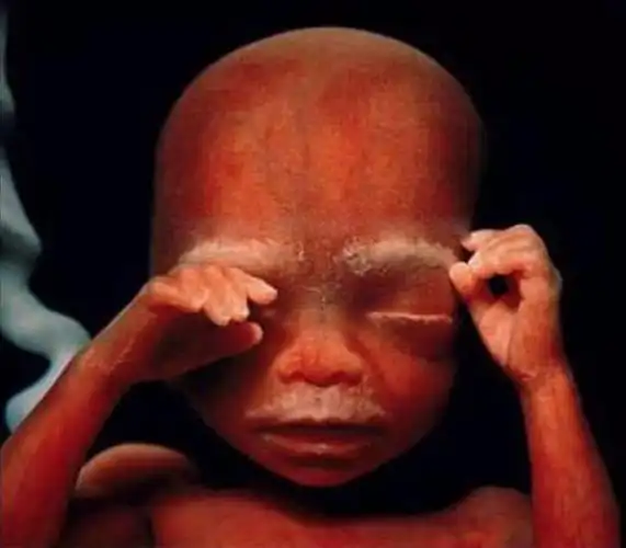 图为6个月后的胎儿已经完全成型,每天需要吸收母亲大量的营养.