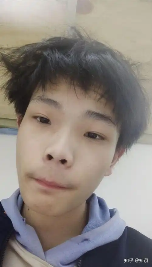 是天生的因为长相的原因从小学到高中一直很内向不自信还有一点社恐