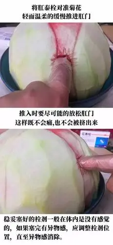 真人演示:如何正确使用肛泰栓