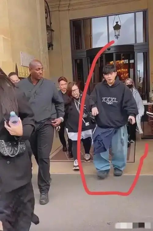 周杰伦近照被曝光看起来非常邋遢有网友发现他秃头好像治好了