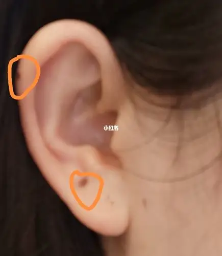 耳朵有痣_面相识人_星座命理_星座命理其他