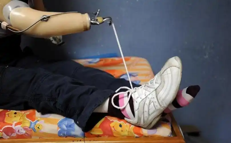 16岁女孩如今仍坚强地用口咬着笔写字,画画|女孩|假肢|危地马拉_新浪