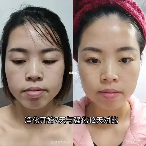 腰小了,脸部皮肤紧致了