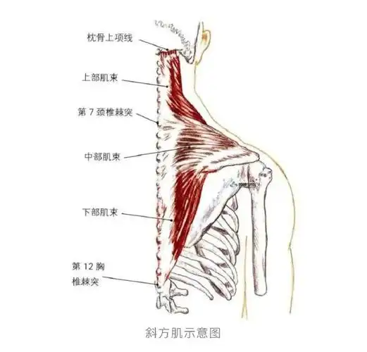 高新服务 生活百科##肩颈痛的人多是斜方肌出了问题