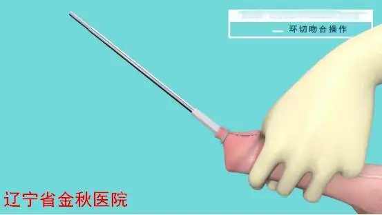 专家简介柳东辉,男,1972年9月出生,主任医师,博士,现任辽宁省金秋医院