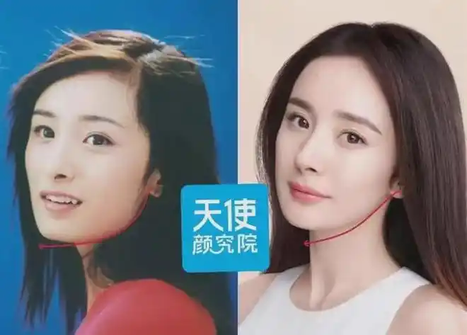 杨幂脸型的方,还是由于下颌角转角位置低,进而显整张脸方且笨重.