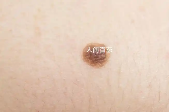 苦情痣是什么意思苦情痣人有什么特殊的福气