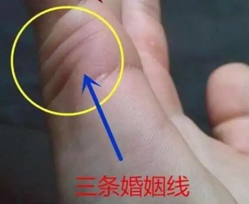 三条婚姻线应该看哪条 女人婚姻线最准的解答是什么