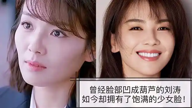 曾经脸部凹陷成葫芦的刘涛,如今却拥有了饱满少女脸?