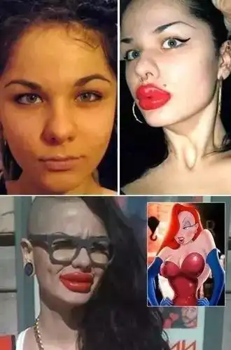 轰动全球的整容失败惨案,很惨特别是最后一个_凤凰网娱乐_凤凰网