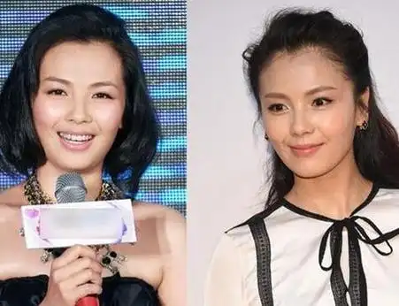 图刘涛整容前后照片对比方脸变尖下巴直教人不忍直视