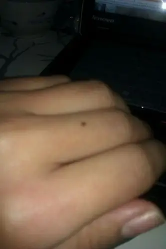 左手中指黑痣有什么寓意吗