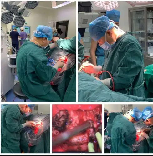 市二院神经外科新近完成两例高难度脑膜瘤手术