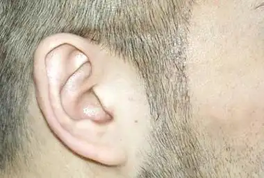 怎么修鬓角男生_脱毛膏可以脱鬓角的头发吗_帮美记植发整形网