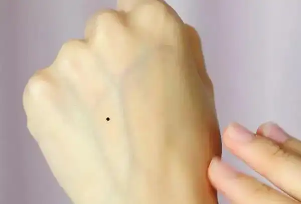 手背有痣代表什么财运好感情不畅